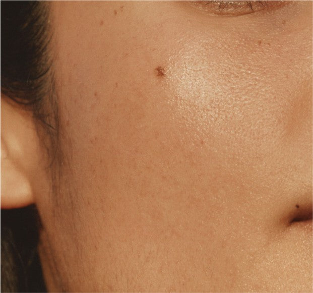 Everything You Need to Know About AHA Exfoliants